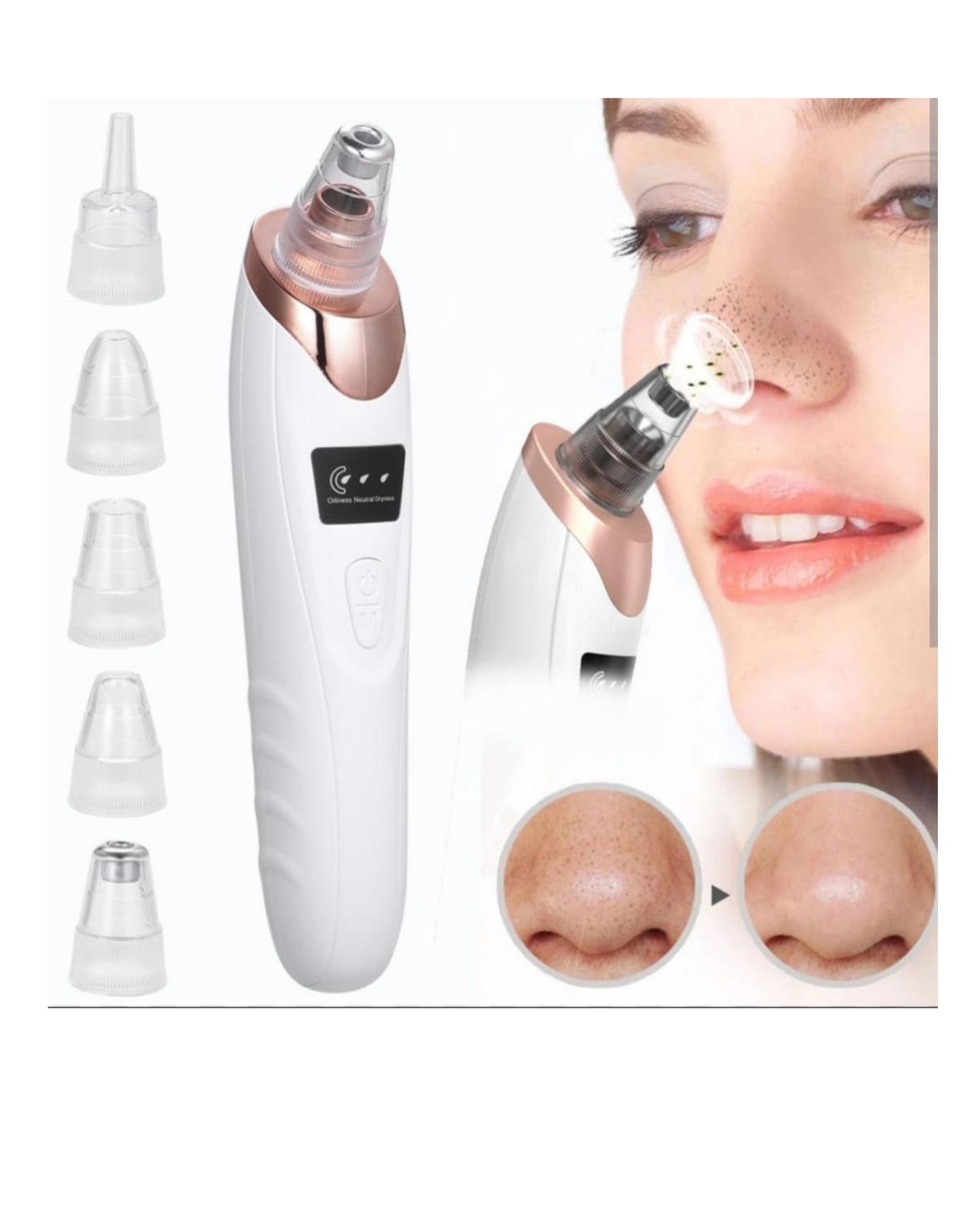 Electric Blackhead Suction Remover